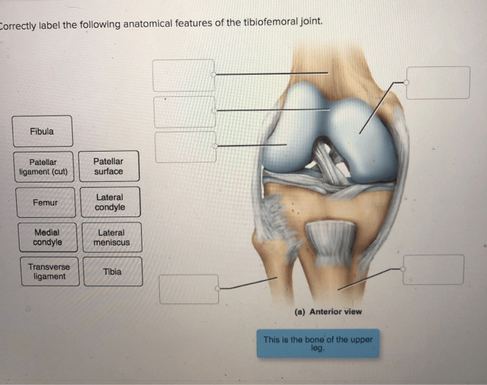 Correctly label the following anatomical features of the tibiofemoral joint.