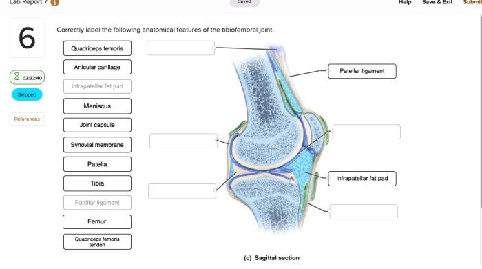 Correctly label the following anatomical features of the tibiofemoral joint.