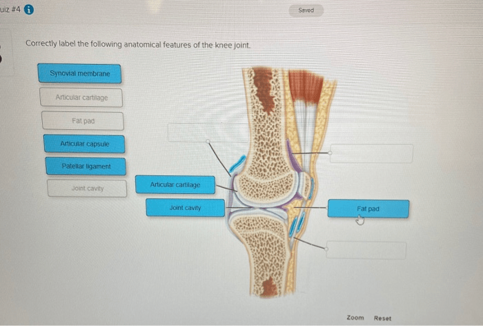 Correctly label anatomical tibiofemoral hyoid vertebral thoracic bone