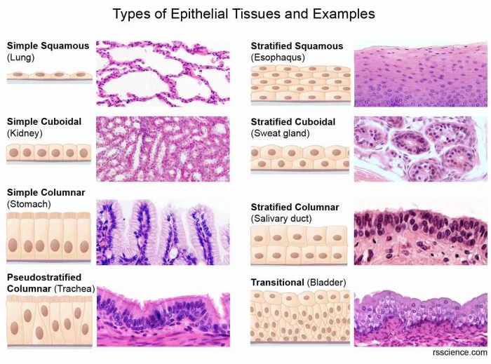 Epithelial tissue biopsies worksheet answers